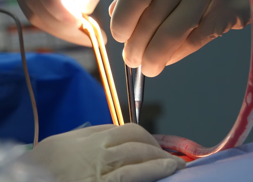 Advanced Surgical Wound Care in Kerala, Kochi